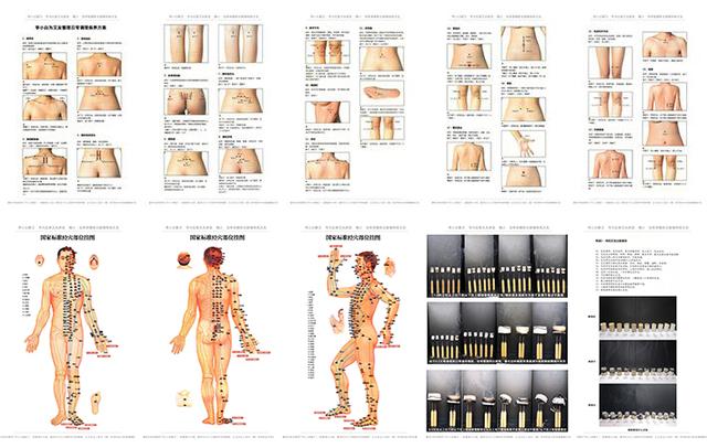 中医传统化脓灸,古人为什么用艾叶艾灸