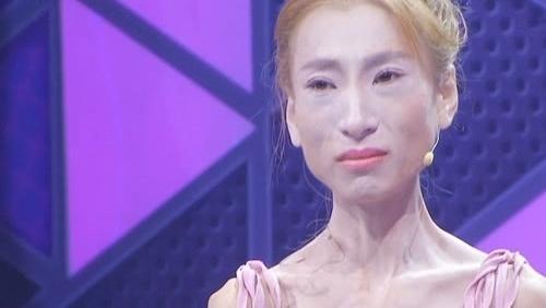 瘦到皮包骨头,瘦到八十斤真的好看吗