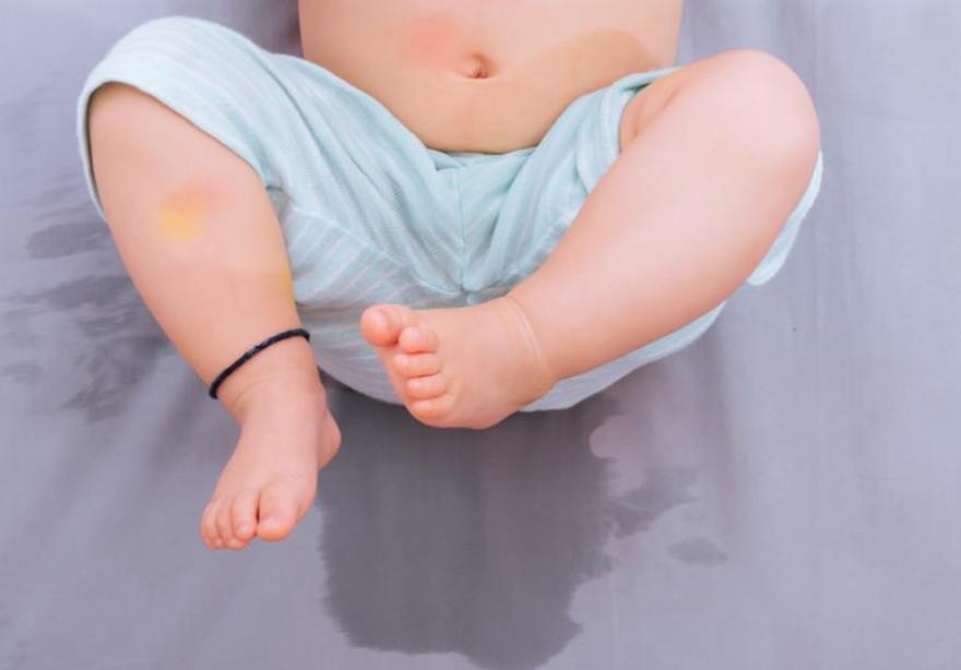 北京天使儿童医院治疗遗尿症怎样,石家庄治疗儿童遗尿症