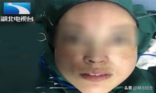 女子花三万多元隆鼻却失败,女子花5万隆鼻变畸形