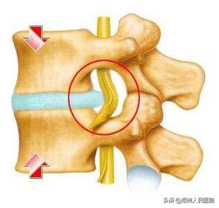 对骨科微创技术的认识,骨科手术与保守治疗对比