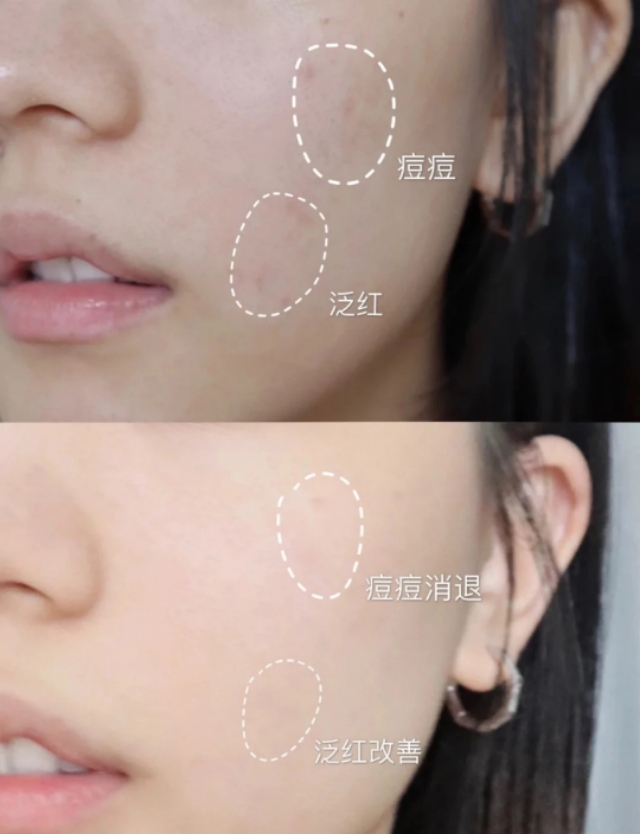 科颜氏金盏花保湿面霜,科颜氏金盏花面霜推荐买么