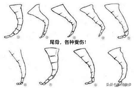 屁股后面隐隐作痛,屁股上面的小尾巴疼什么原因