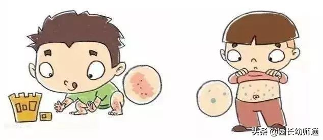 幼儿春季预防感冒传染病教案,幼儿预防春季传染病图片