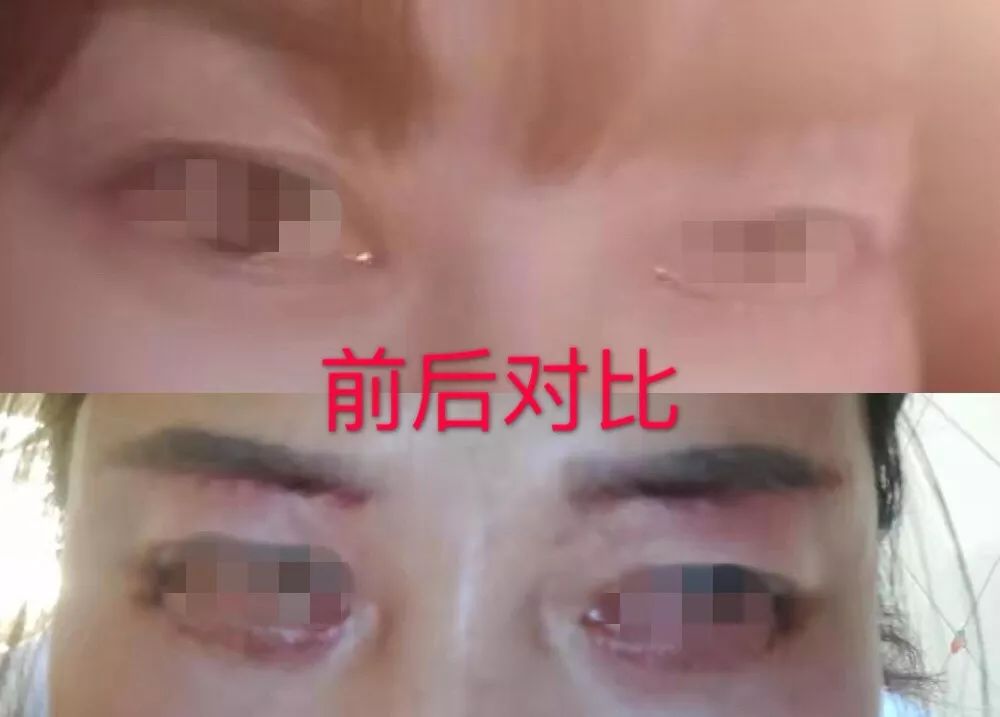 包头一女子整容后，丈夫连儿子都不让她见，因为……