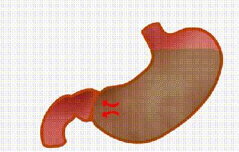 喝一点水就尿特别多是肾虚吗,一喝水就尿和不尿哪个身体更健康