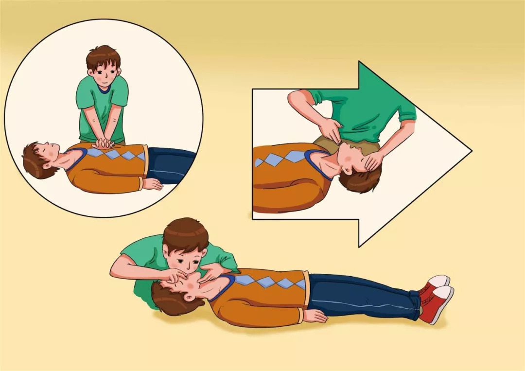 成年人心肺复苏最常用方法,心肺复苏可以挽救哪类心脏骤停