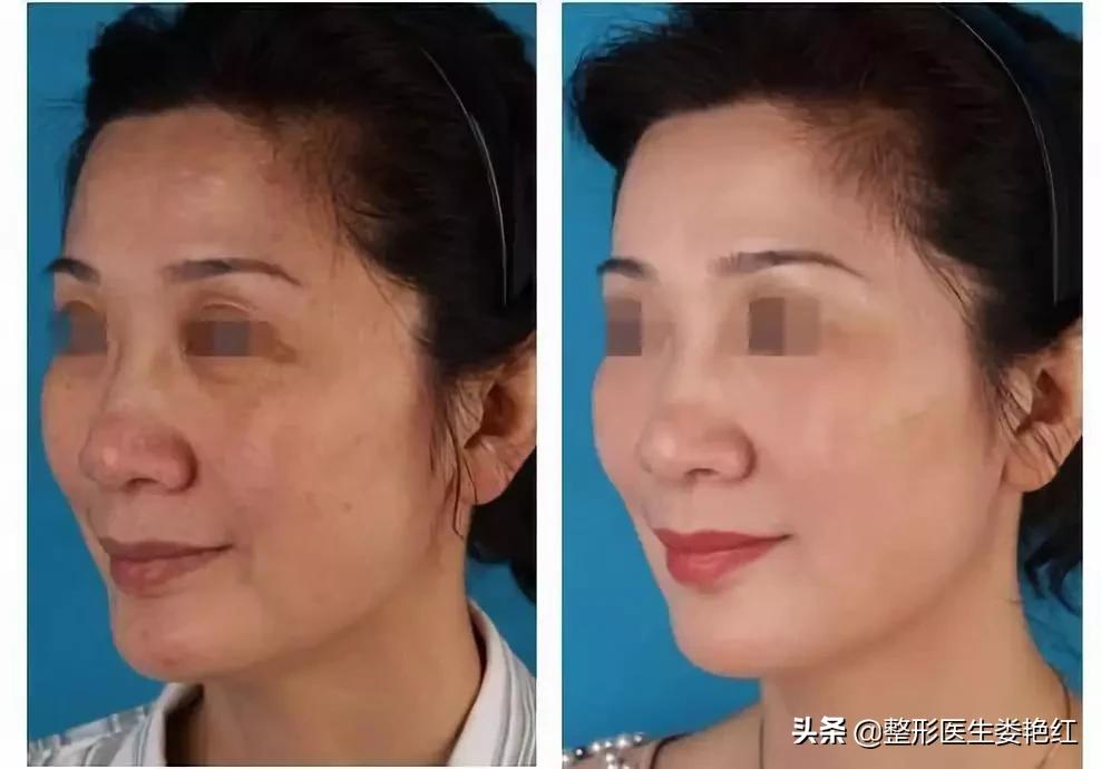 变美逆袭逆龄抗衰变美小妙招,逆龄抗衰手法一起开启变美之路