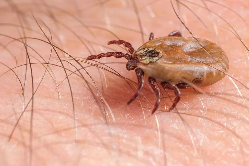 清洗头皮毛囊会长头发么,头皮毛囊清理洗头方法