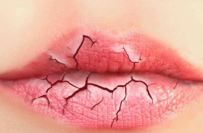 什么办法可以祛脸上的荞麦皮,脸上荞麦皮去掉中医小妙招