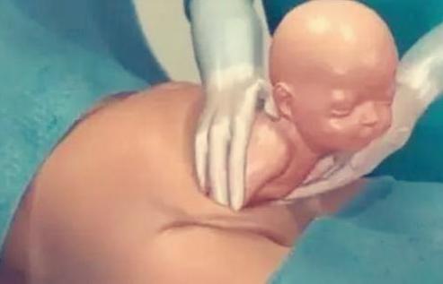 7张图揭露产妇“剖腹产”全过程，男人都该看，网友：母爱太伟大