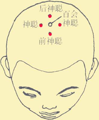 腹泻针灸哪里效果最好,胃下垂针灸最佳治疗方法