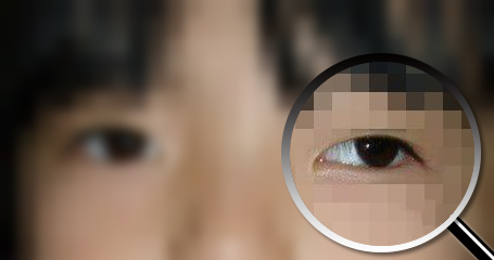 只有一只眼睛近视需要戴眼镜吗,一只眼近视一只不近视要戴眼镜吗