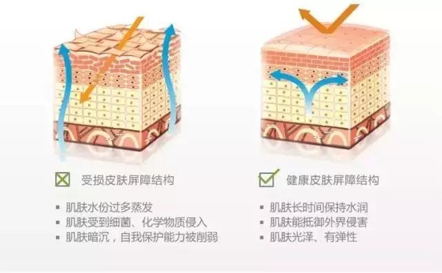 冬天面部角质层薄起皮泛红,换季敏感皮肤泛红脱皮怎么办