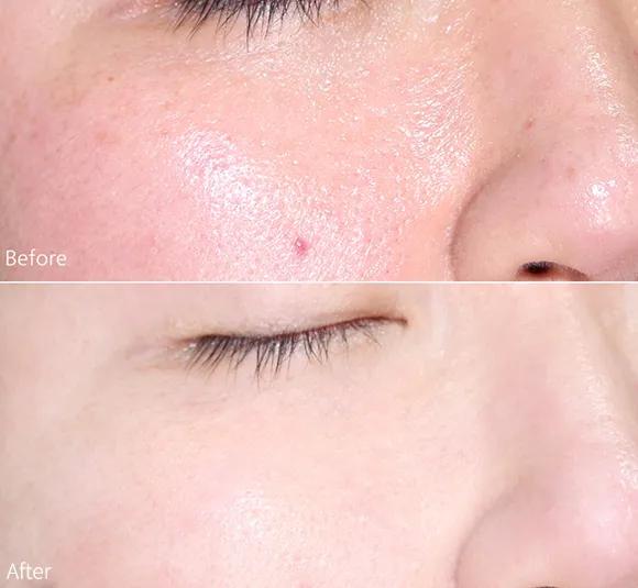 死海泥洗面膜怎么样,死海泥面膜的神奇功效是什么