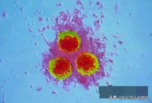 全身痒痒的小水痘,水痘痒痒的