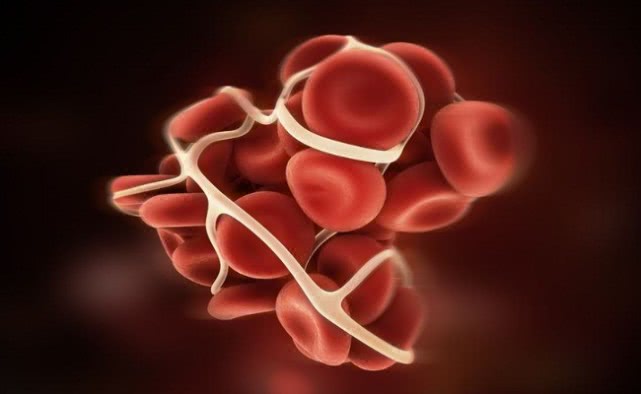 月经不尽子宫内有血块什么情况,什么妇科病会导致月经出现血块