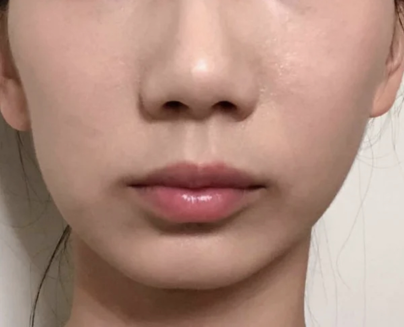 大小脸影响大吗,大小脸能不能改善