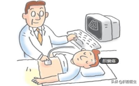 胆囊息肉多久会变胆囊癌,胆囊息肉3mm*2mm是胆囊癌吗