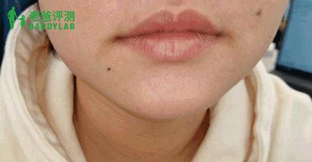 为什么天天涂唇膏嘴巴还是干,涂唇膏后嘴唇干怎么办
