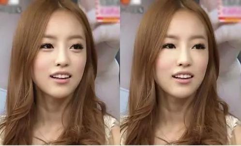 有眼袋的直观感受,眼袋真实案例分享