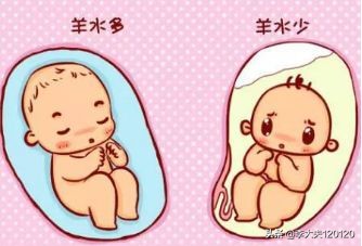 羊水指数只有20,如果羊水少的话胎心会正常吗