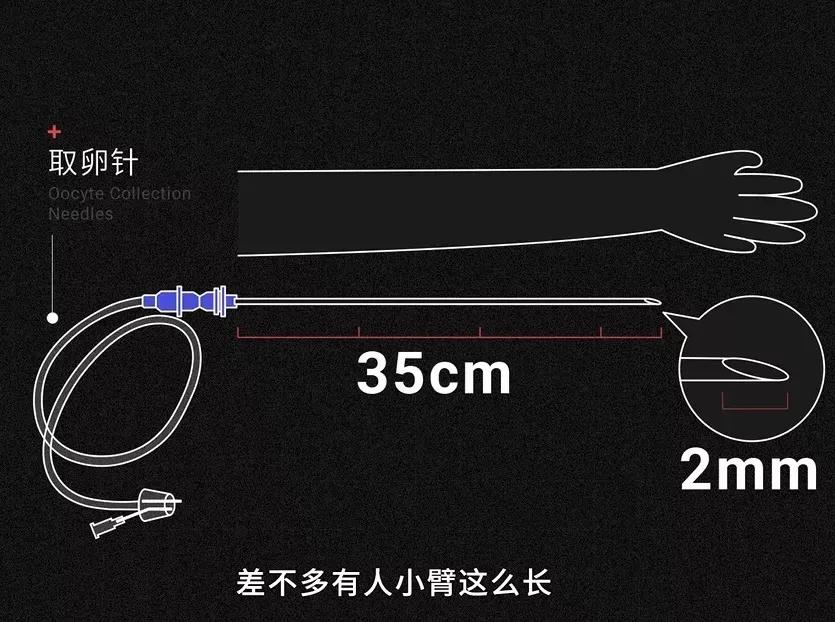 郑爽回应“代孕”风波！这次是真的实锤了