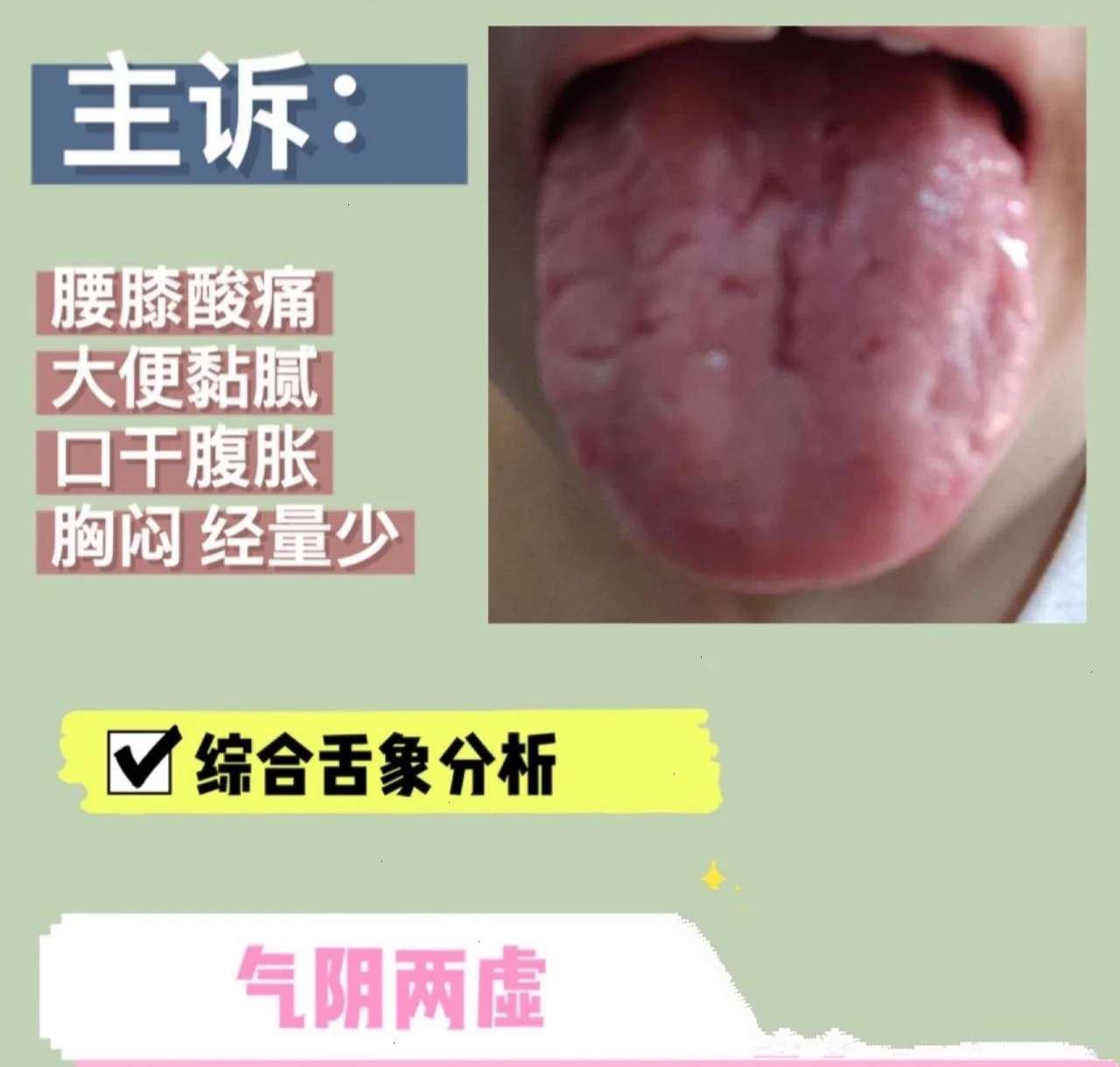 肾阳虚腰痛与肾阴虚腰痛的区别,男人腰疼是肾阴虚需要吃什么药