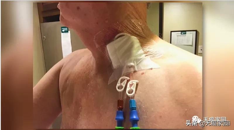 他们带着癌症幸存者标签，活得精彩！这些重磅新药新技术值得关注