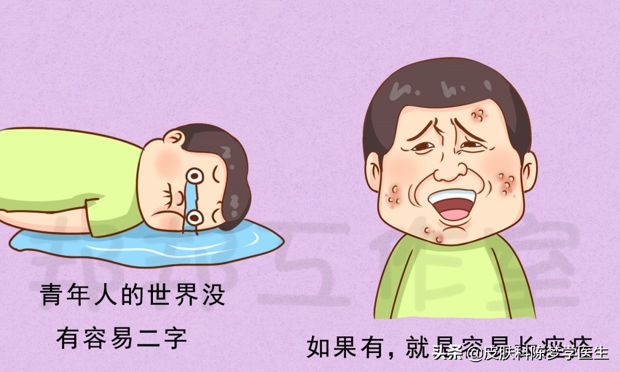 脸上青春痘用什么护肤品,青春痘抗组胺药物有哪些