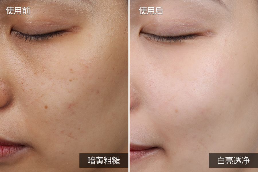 琚佸濮楁帹鑽愯憽钀勭苯鎶よ偆,琚佸濮楄憽钀勭苯绮惧崕