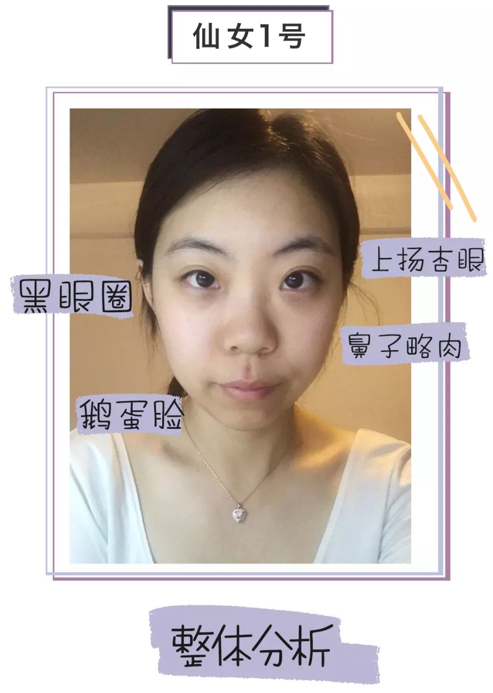 求改善痘痘真实办法,想改变脸上痘痘