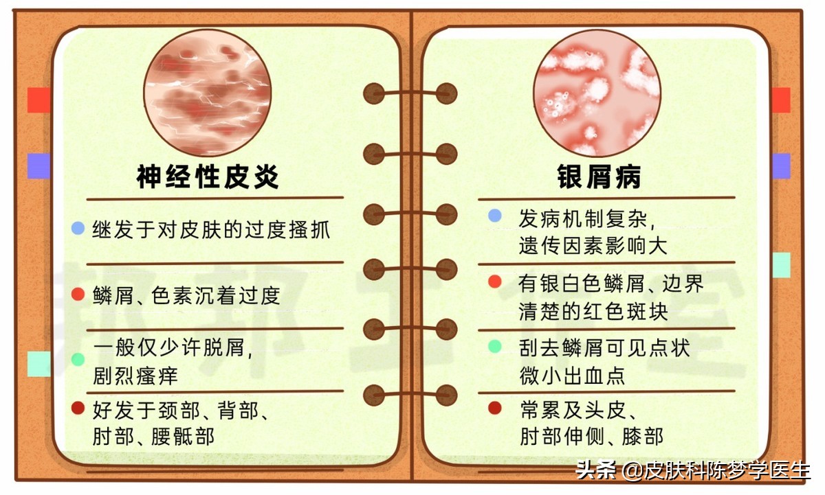皮肤上长红斑、脱屑，是不是得了牛皮癣？