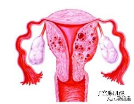 经期遇上浑身疼痛怎么办,经期闹心怎么缓解