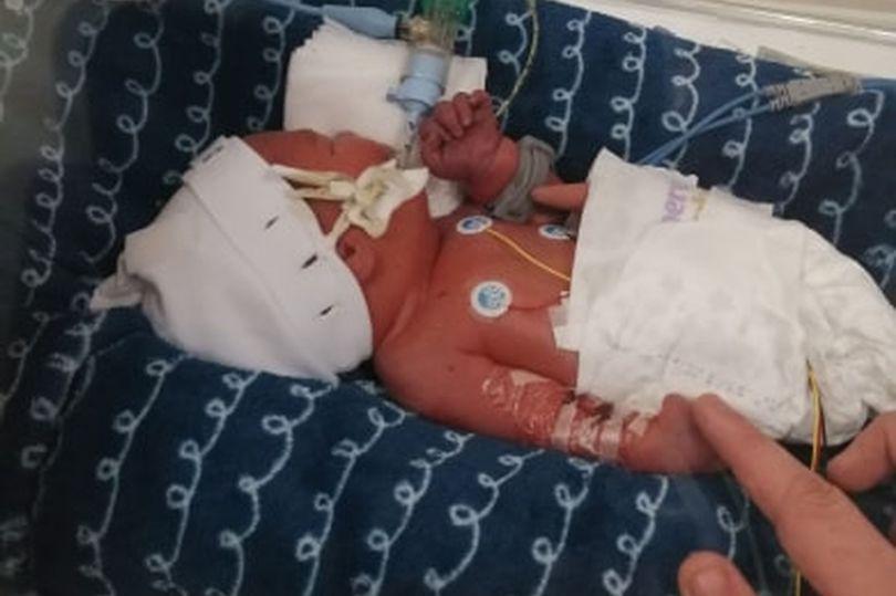 人鱼宝宝的降生,人鱼宝宝长大后图片