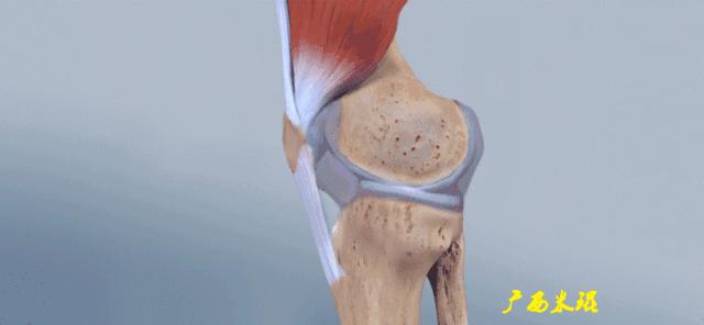膝盖扭伤前交叉韧带损伤可以热敷,前交叉韧带扭伤最快自愈方法