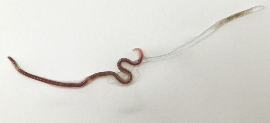 日本人生鱼片寄生虫发病,吃生鱼片弓形虫感染