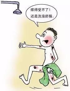 头皮痒头皮屑多脱发严重怎么回事,头皮屑结痂成大块伴有瘙痒脱发