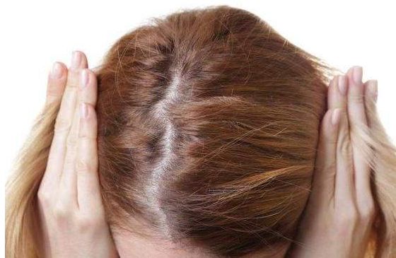 产后脱发严重新妈咪该如何应对,产后妈妈脱发的原因和治疗