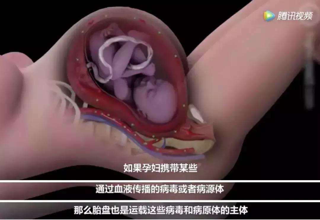 浜轰綋鑳庣洏鏈夌瀵嗗悧,鎻浜轰綋鑳庣洏