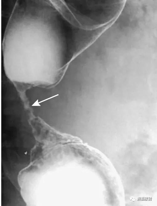 腹部影像图片大全,乙状直肠疼痛位置图片