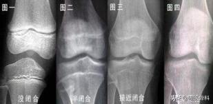 跳高体育之星,跳高的理想身高