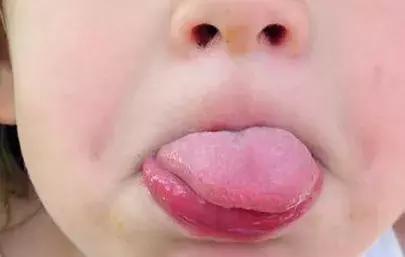 宝宝火气旺盛怎么调理,宝宝火气很大