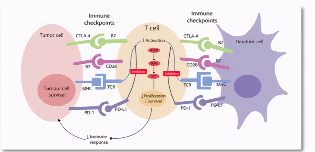甲状腺癌晚期淋巴转移,甲状腺癌晚期全身酸痛