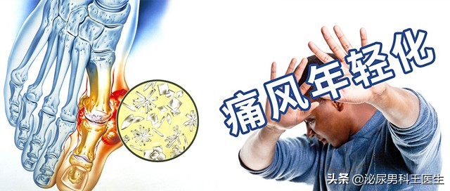 尿酸高身体会出现哪些症状,尿酸高怎么调理下来还需要吃药