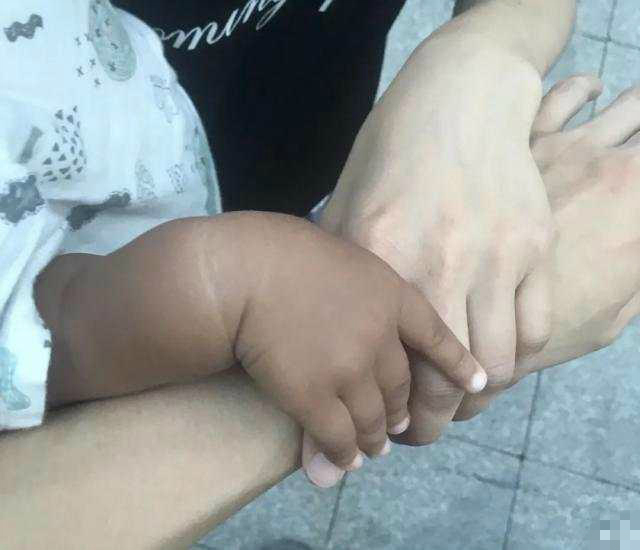 小孩30个月突然变黑,女儿3岁后皮肤越来越黑