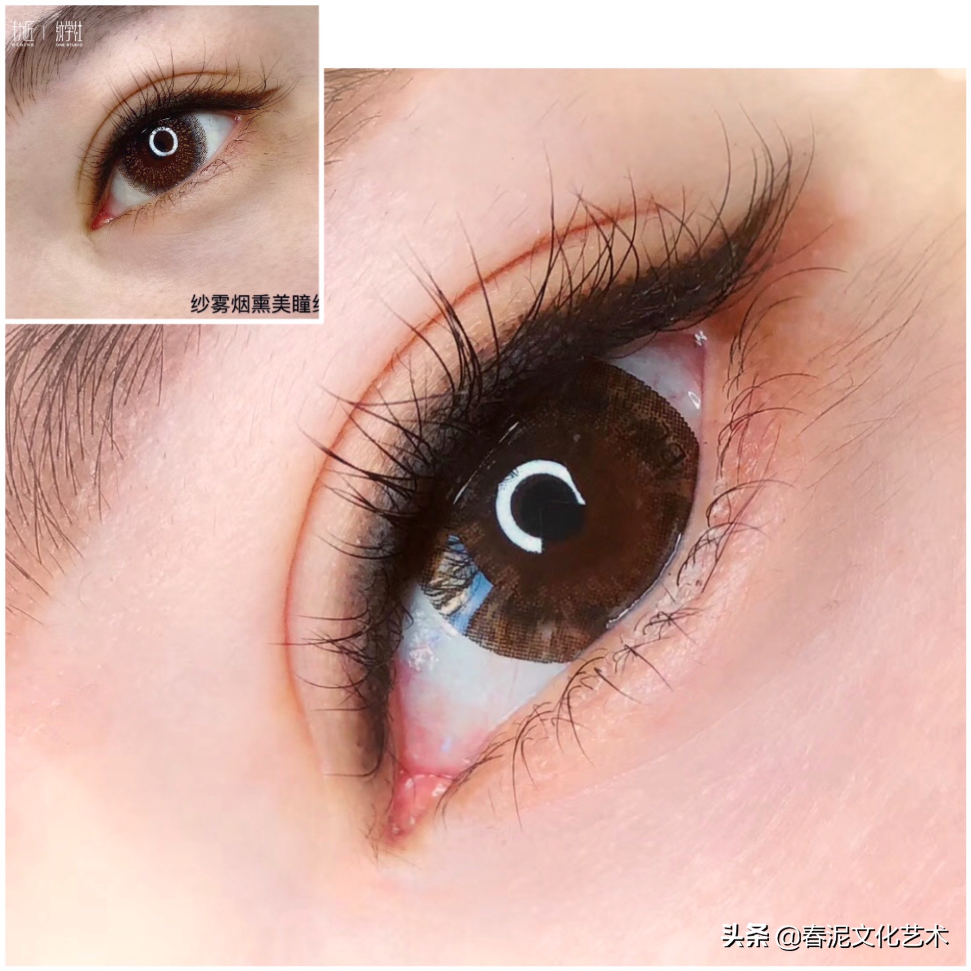 为什么纹美瞳线会露眼白,纹美瞳线第二天肿怎么快速消肿