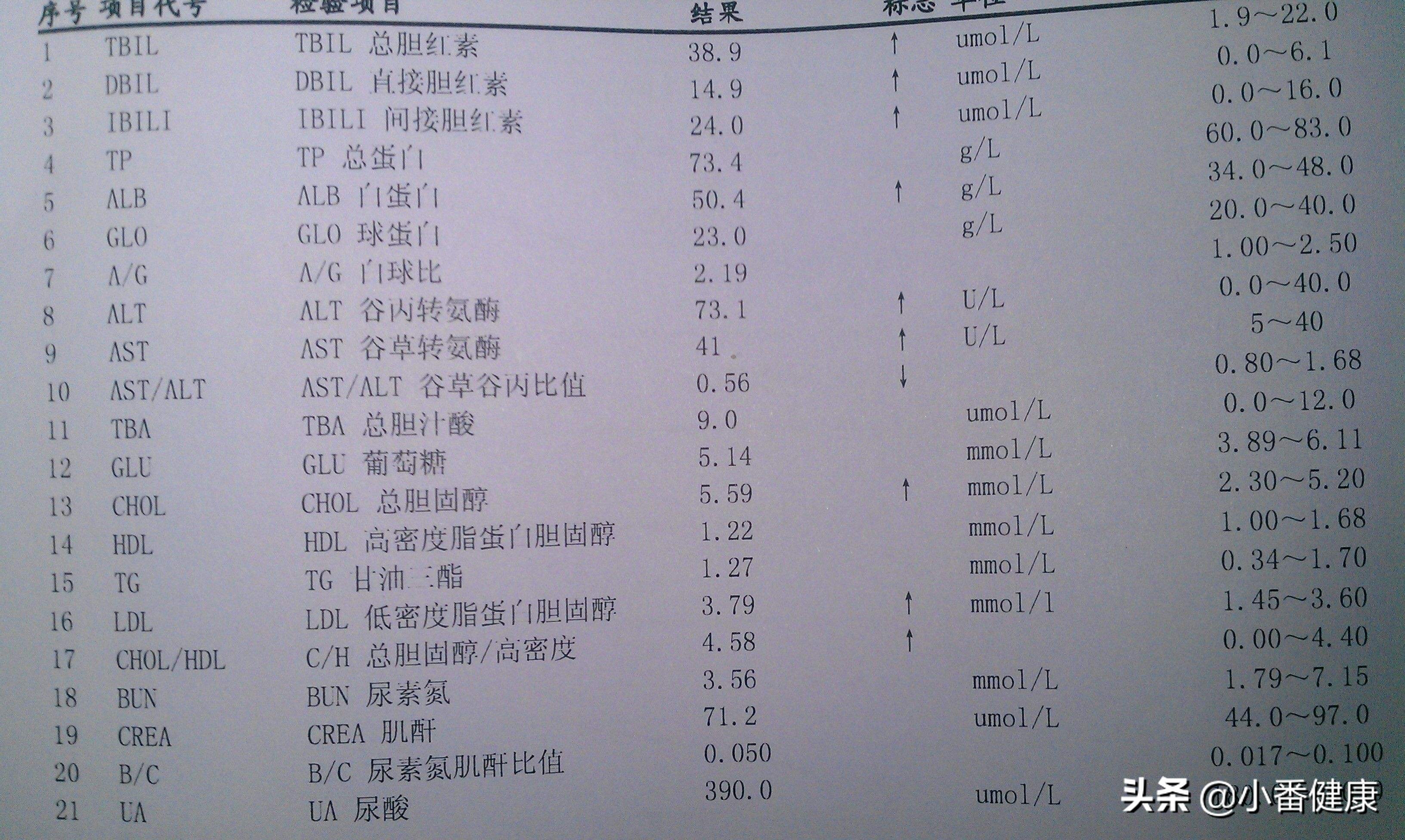 乙肝两对半145是大三阳还是小三阳,乙肝两对半报告135阳性