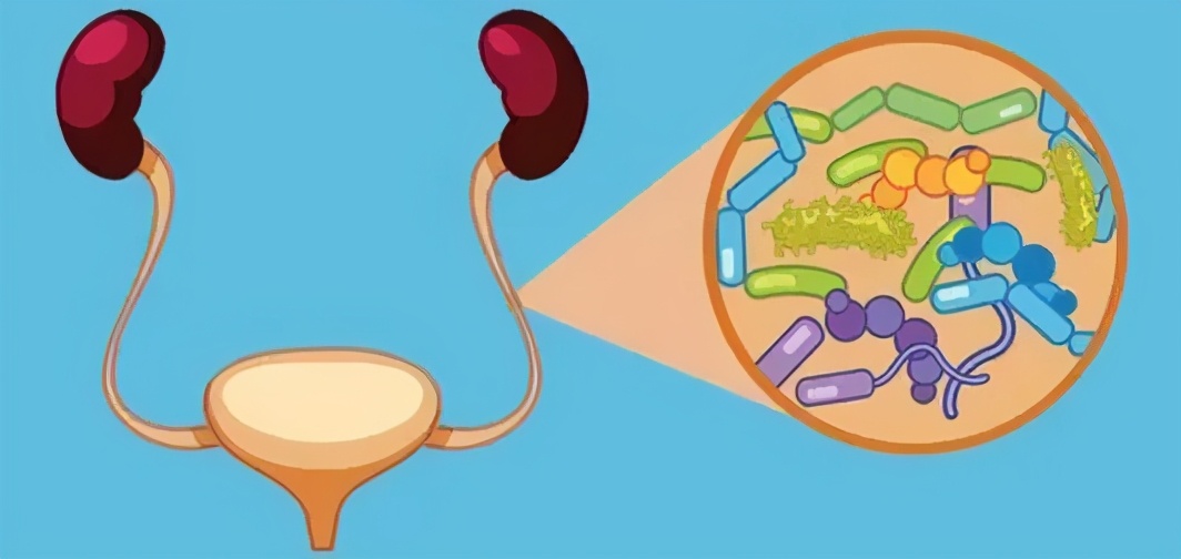 膀胱炎、白带过多、盆腔炎、尿淋伴湿疹和瘙痒的人注意了，医生给你荐药来了