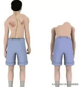 郑大五附院肌肉疼痛诊疗中心,郑州大学五附院康复科视频